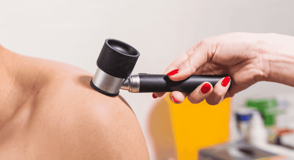 Carcinomes et mélanomes : les cancers de la peau