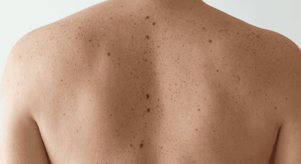 Diagnostics et examens des maladies de peau