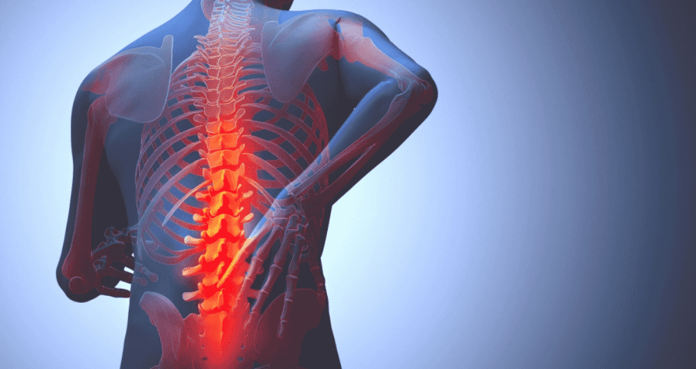 La neurostimulation pour traiter la lombalgie ?