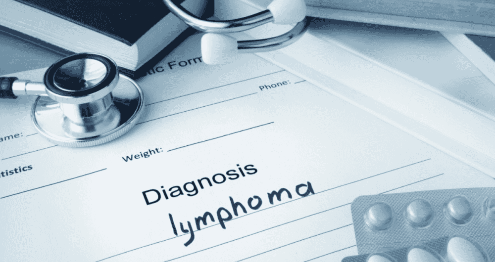 Le Lymphome, un cancer encore mal connu