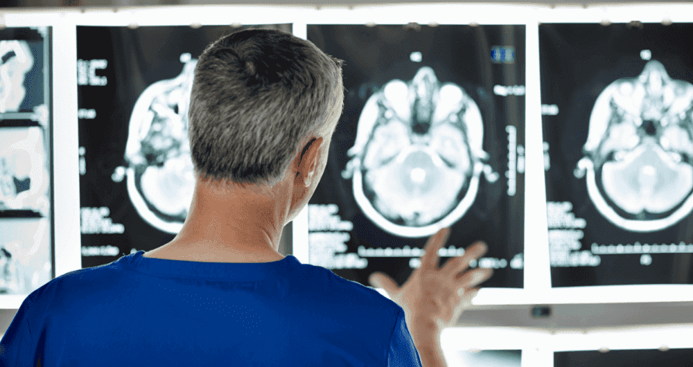 Qu'est-ce qu'un scanner cérébral normal ?