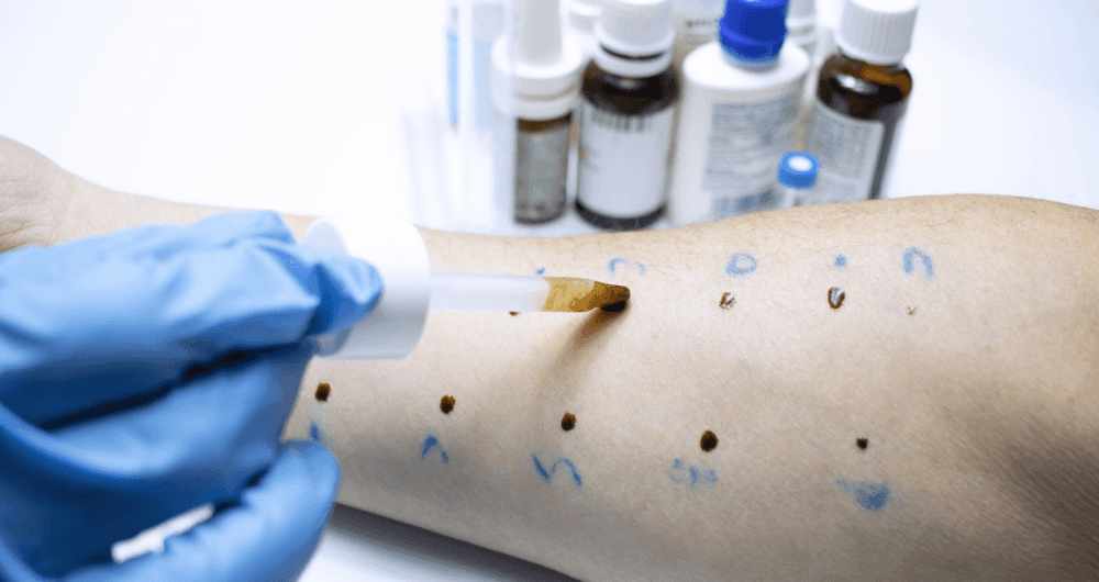 soigner les maladies de la peau