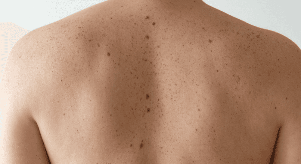 Diagnostics et examens des maladies de peau