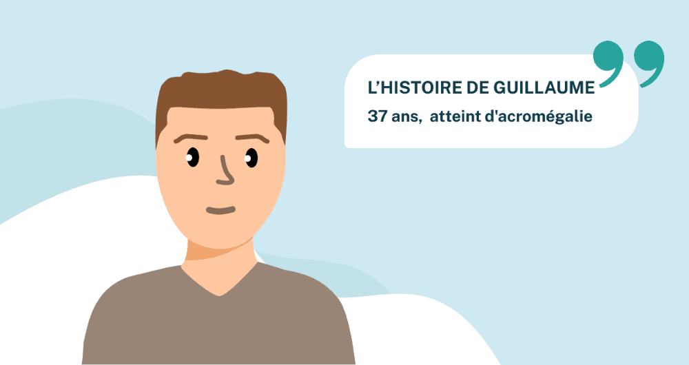 L’histoire de Guillaume, 37 ans, atteint d'acromégalie