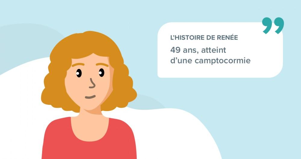 L'histoire de Renée, souffrant d'une camptocormie