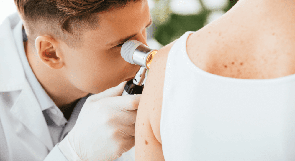 Les maladies rares de la peau chez l'adulte