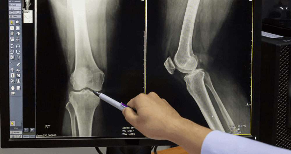 Orthopédie : 7 examens d’imagerie à connaître