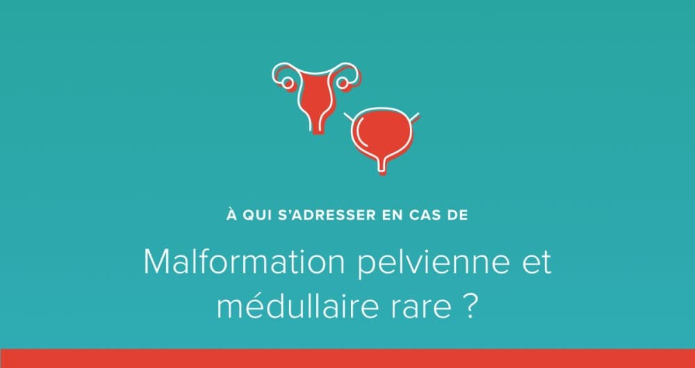 A qui s’adresser en cas de malformation pelvienne et médullaire rare ?