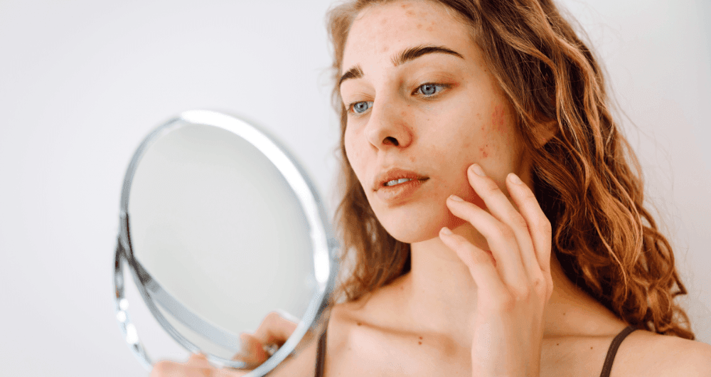 vivre avec un cancer de la peau