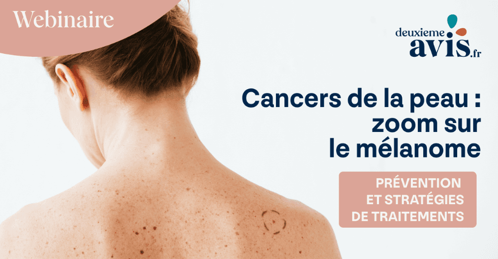 Cancers de la peau, zoom sur le mélanome : prévention et stratégies de traitement. Retour sur notre webinaire
