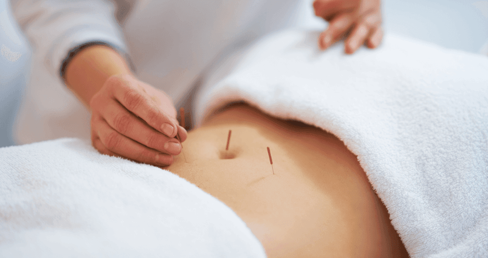 L’acupuncture, un soutien complémentaire à la fertilité