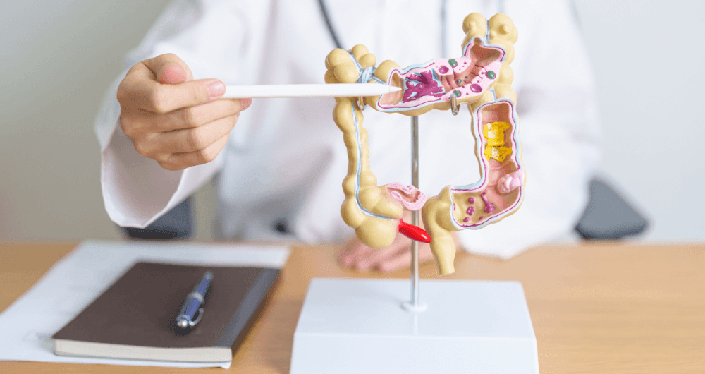 L'endométriose colorectale : symptômes, diagnostic et traitements