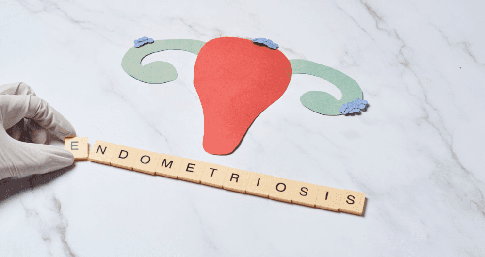 causes endométriose