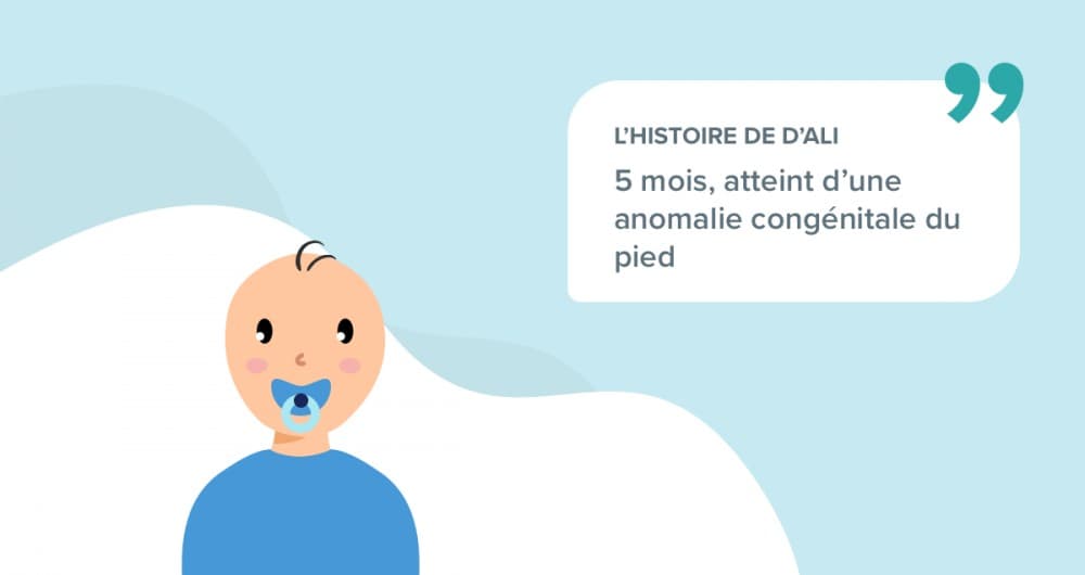 L’histoire d’Ali, 5 mois, atteint d’une anomalie congénitale du pied