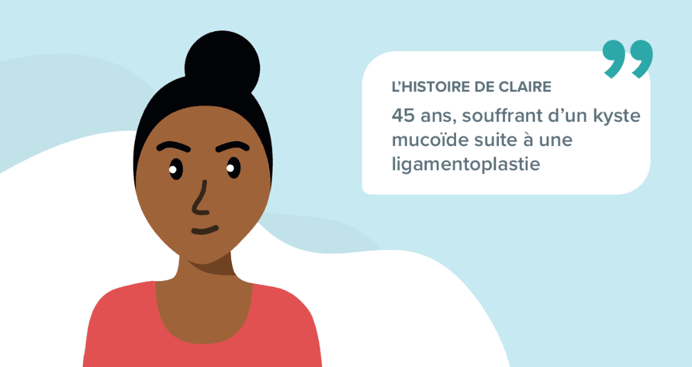 L'histoire de Claire, 45 ans, souffrant d’un kyste mucoïde suite à une ligamentoplastie