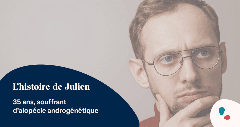 alopécie androgénétique