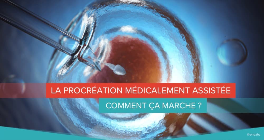 procréation médicalement assistée PMA