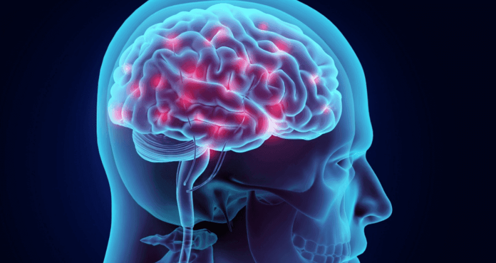 Maladie de Parkinson : le traitement par neurostimulation