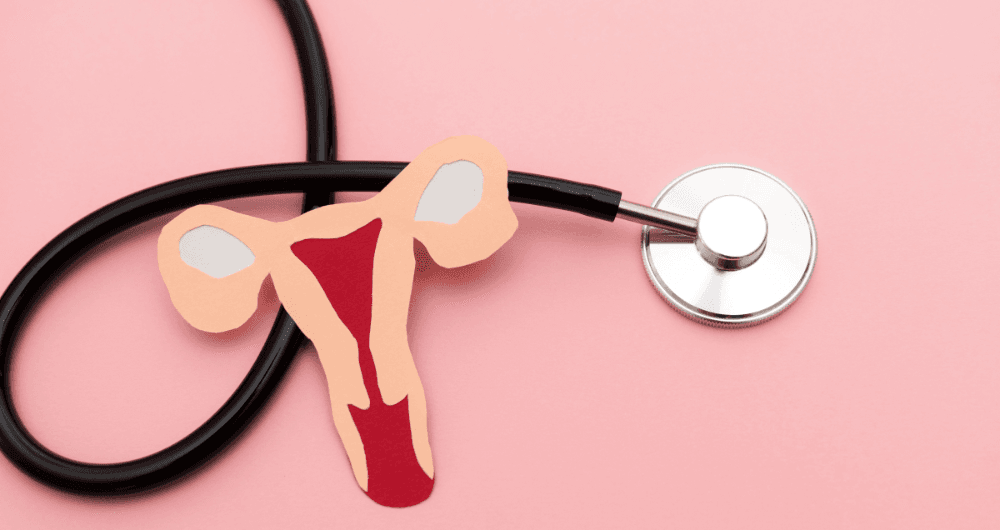 malformations utérines