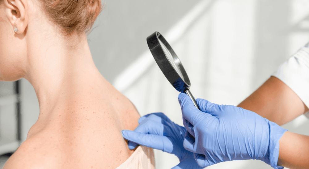 Tout savoir sur la peau et les maladies dermatologiques