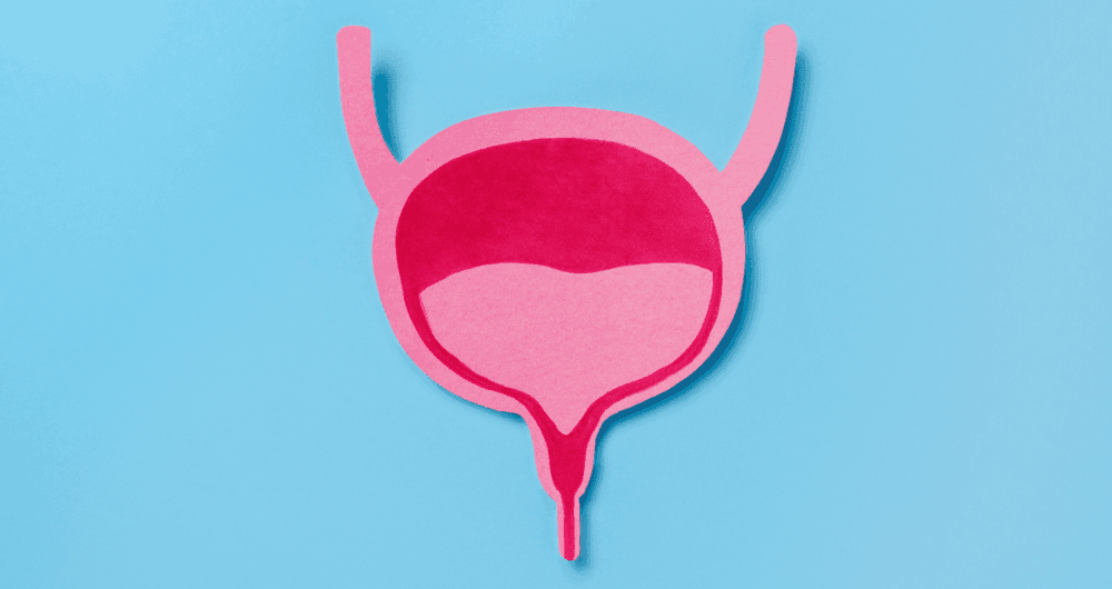 Tout savoir sur le prolapsus urétral chez la fille et la femme