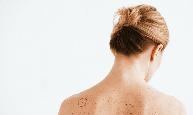 Fracture du tibia : définition, symptômes et avis de spécialistes